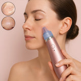 Vacuum Suction Tool with 4 Suction Head for Men and Women (Multi-Color / 1 Set) (USB & Adapter Included)